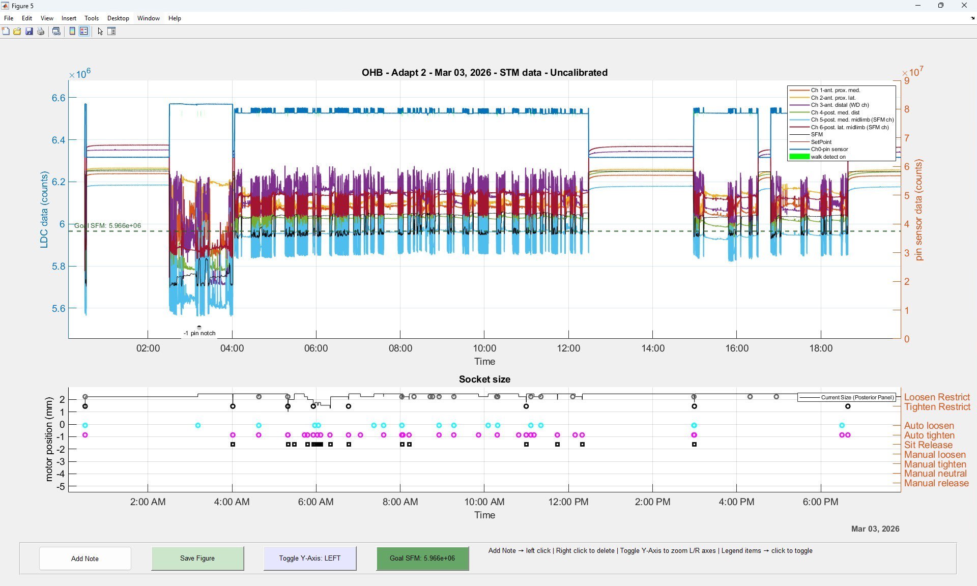 Automated Biomechanical Signal Analysis Pipelines