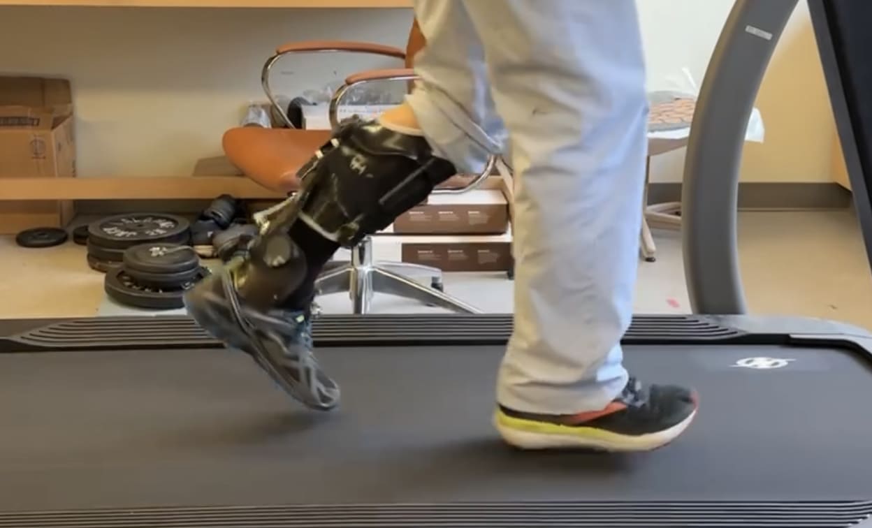 Auto-Adjustable Dynamic Ankle-Foot Orthosis