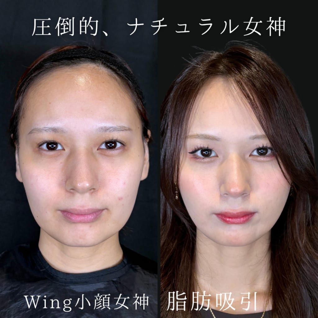 症例のビフォー画像