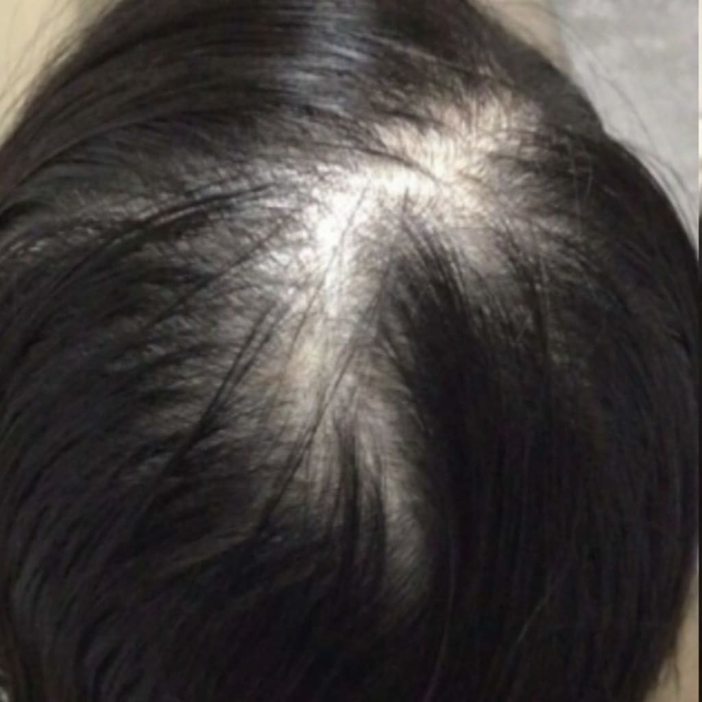 症例のビフォー画像
