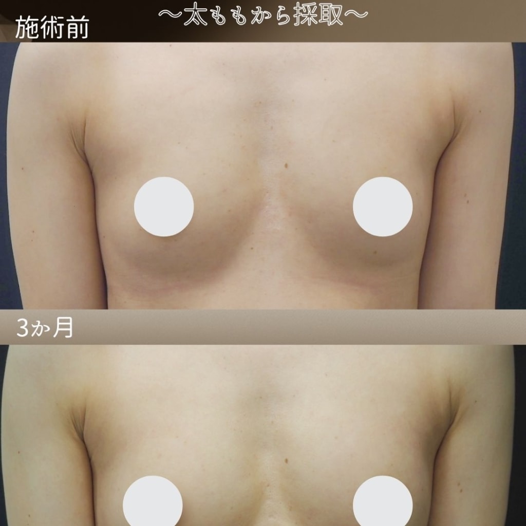 症例のビフォー画像