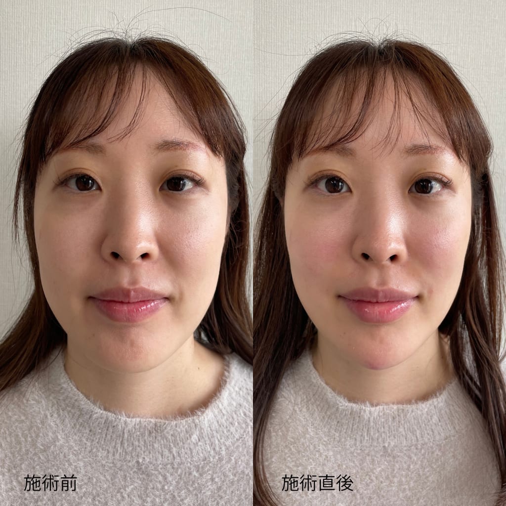 症例のビフォー画像