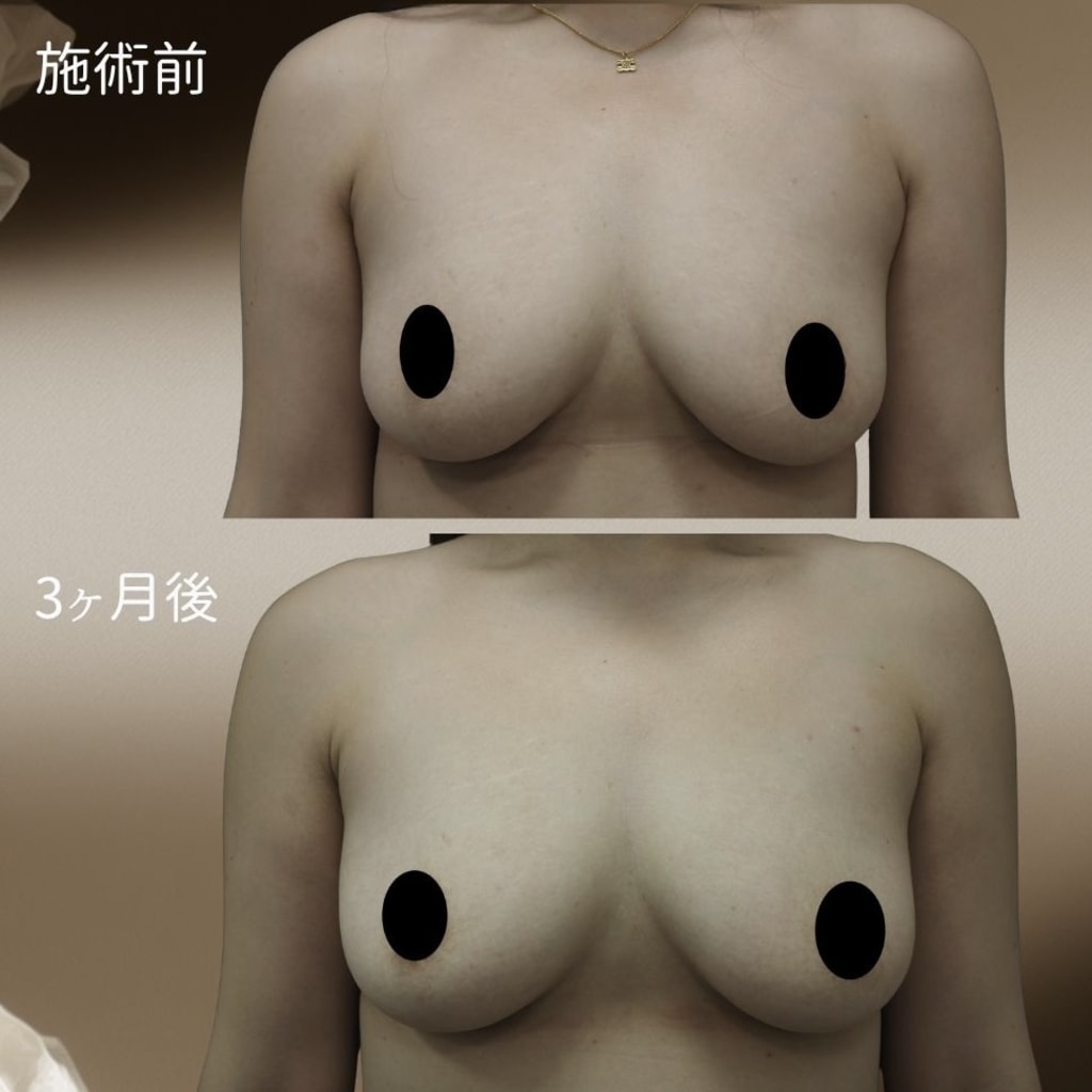 症例のビフォー画像