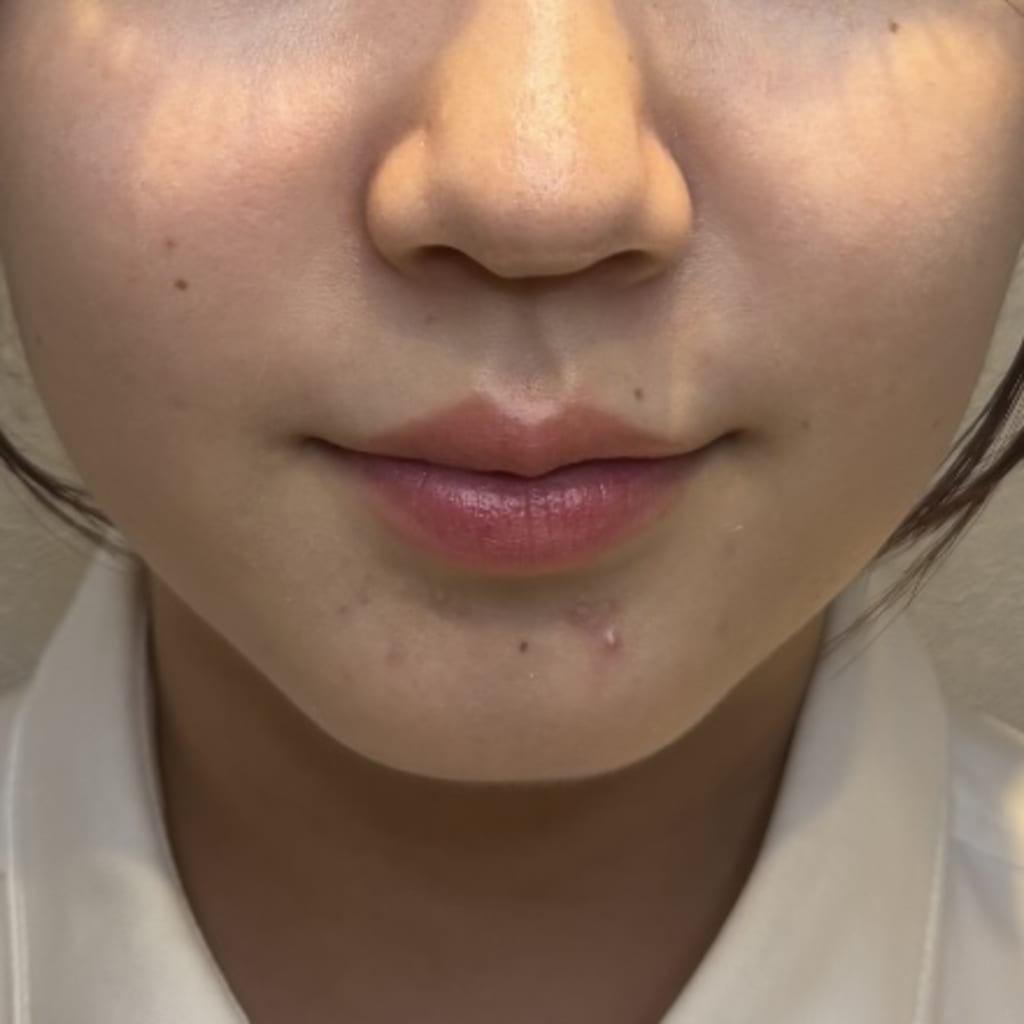 症例のビフォー画像