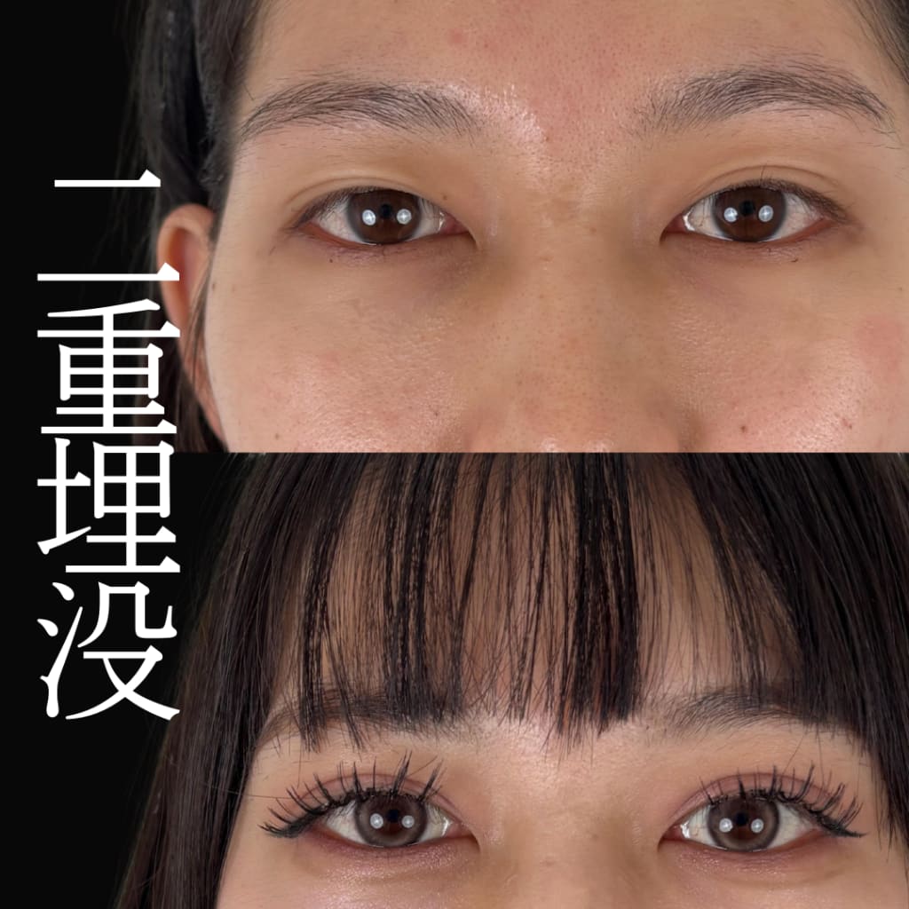 症例のビフォー画像
