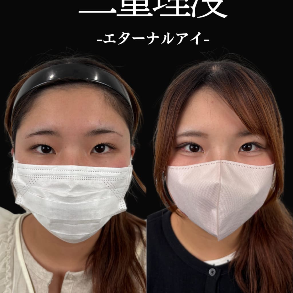症例のビフォー画像
