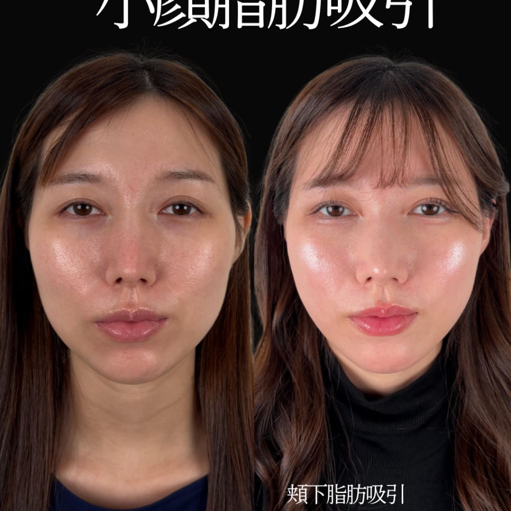 症例のビフォー画像