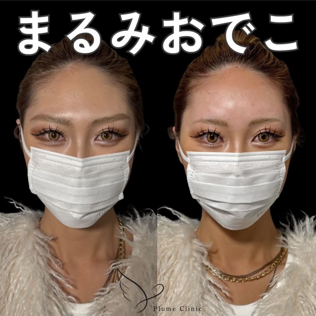 症例のビフォー画像