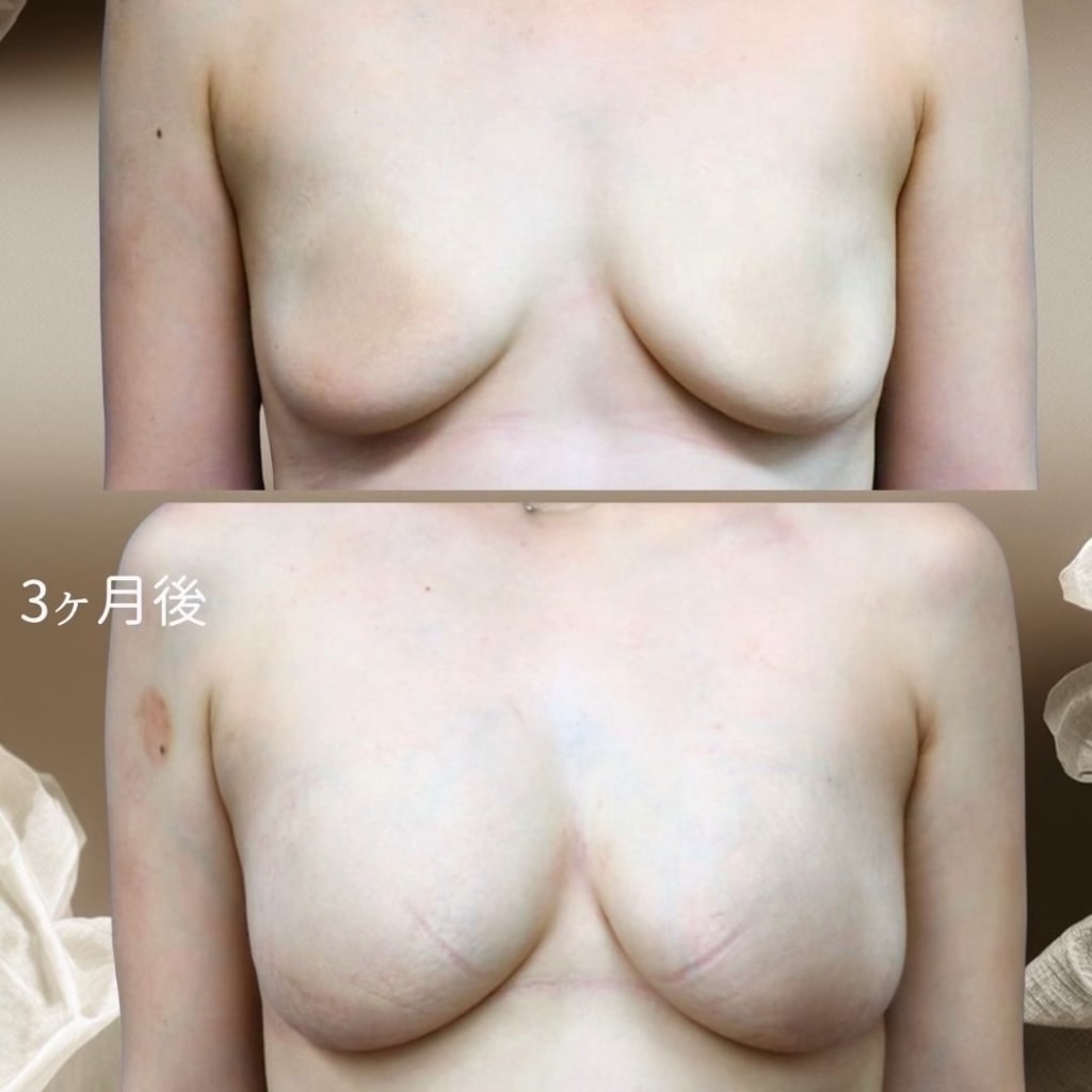 症例のビフォー画像