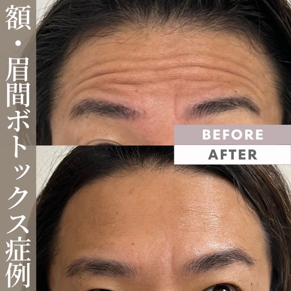症例のビフォー画像