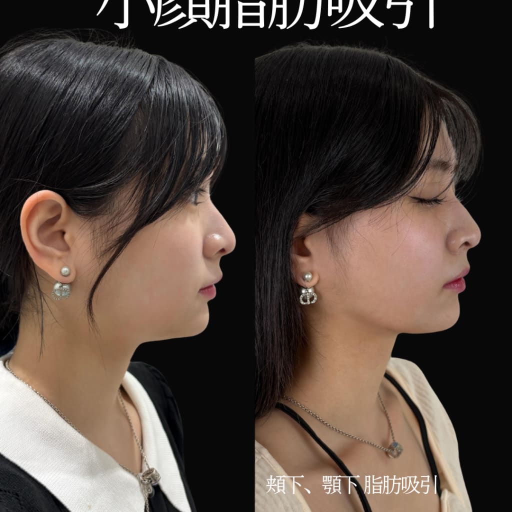 症例のビフォー画像