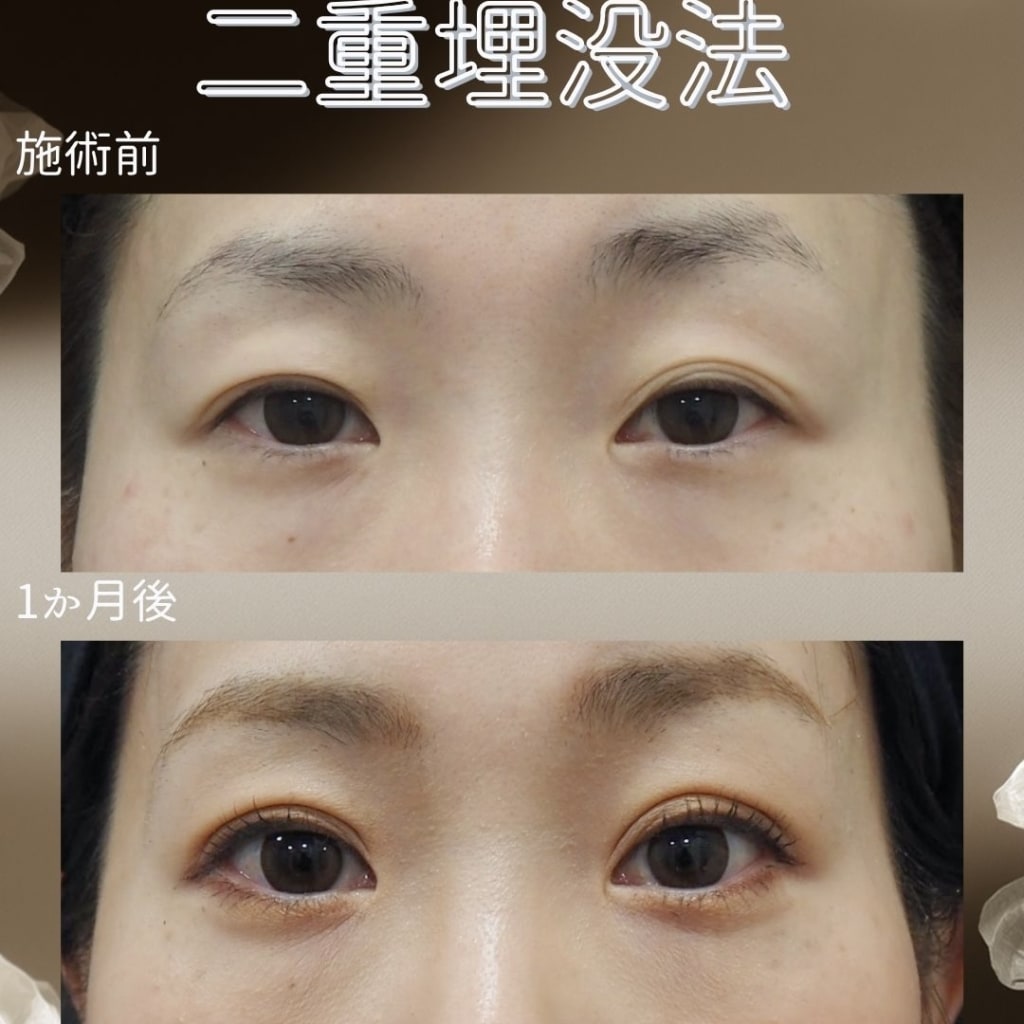 症例のビフォー画像