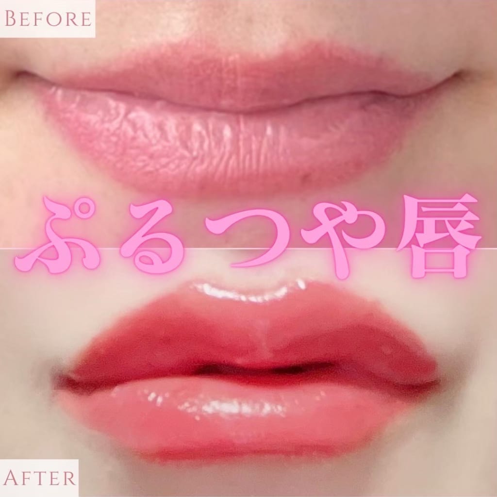 症例のビフォー画像