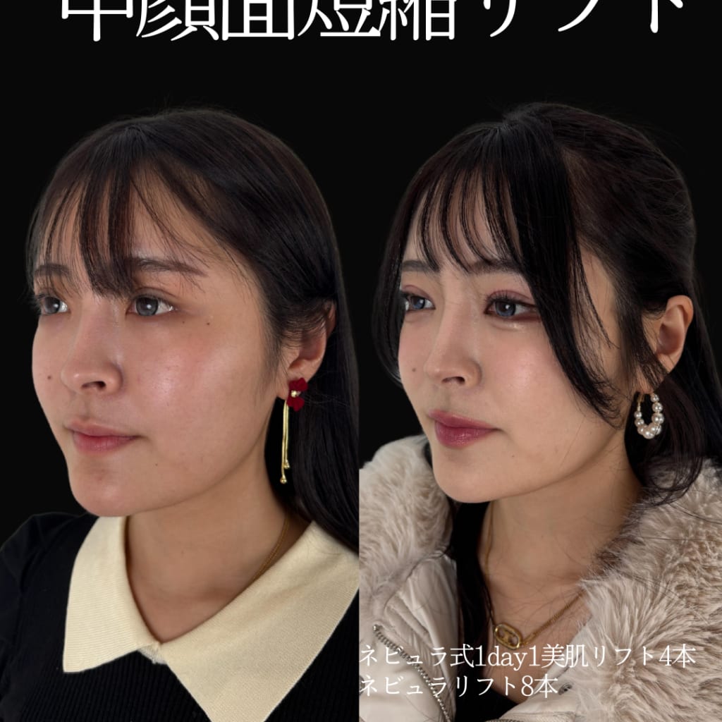 症例のビフォー画像
