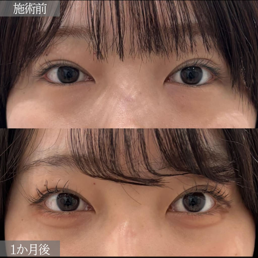症例のビフォー画像