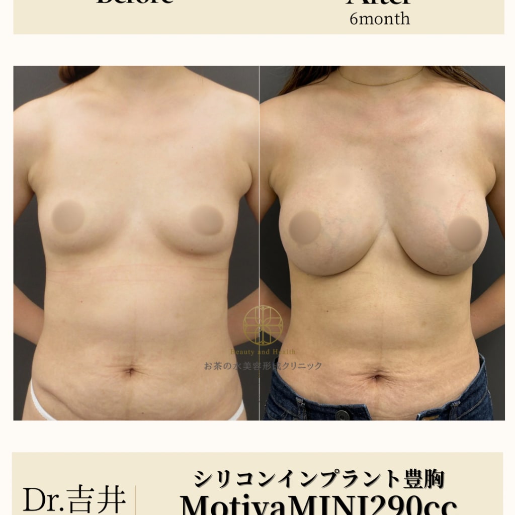 症例のビフォー画像