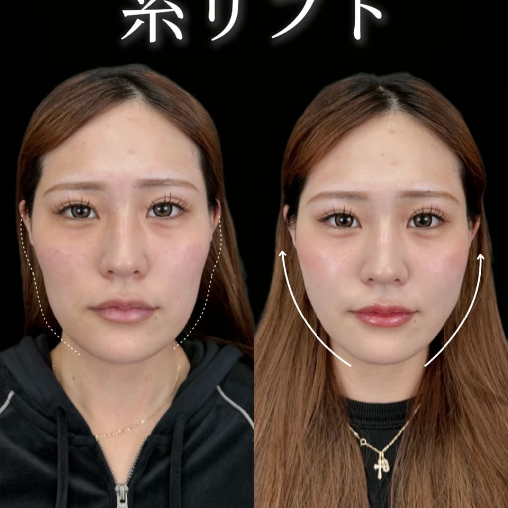症例のビフォー画像