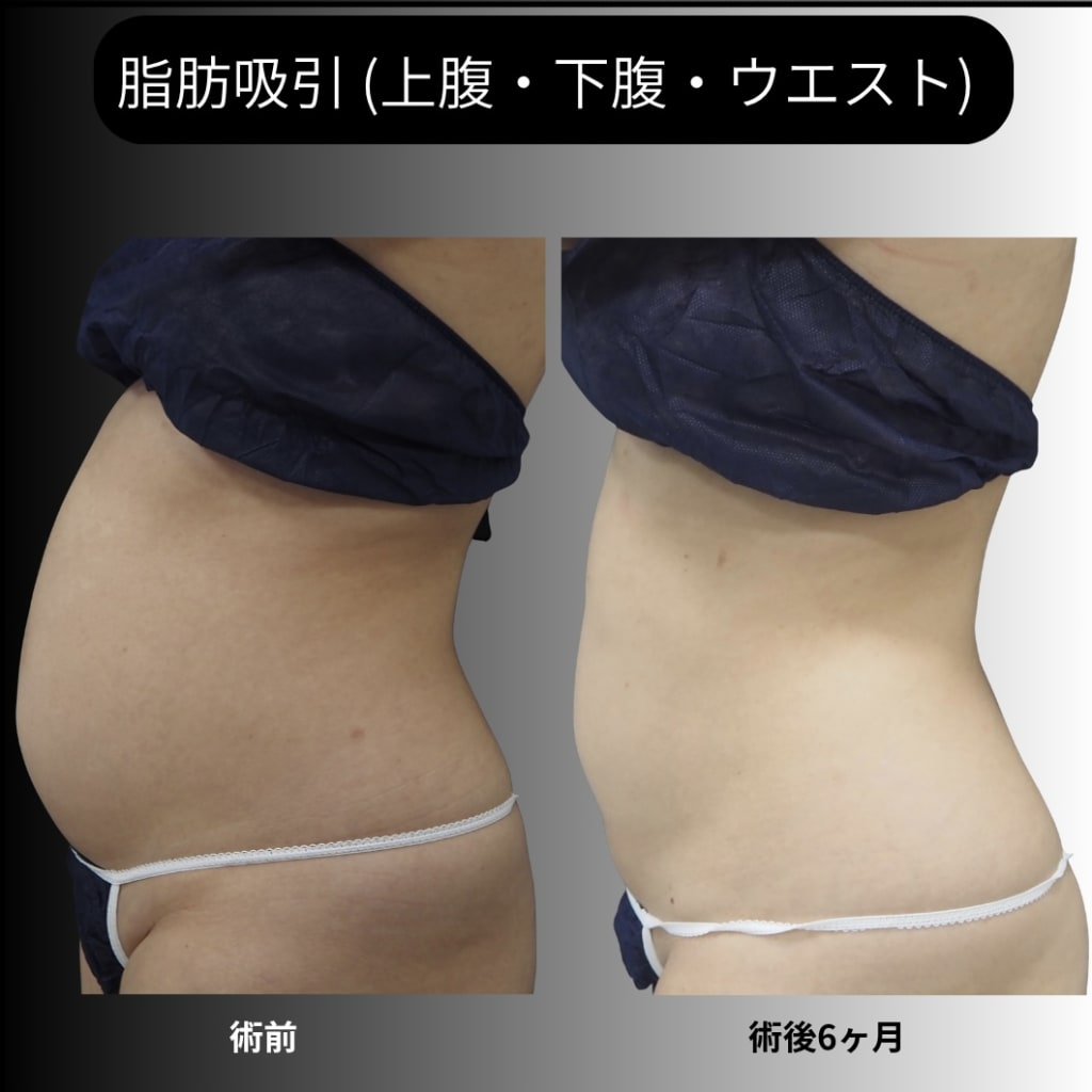 症例のビフォー画像