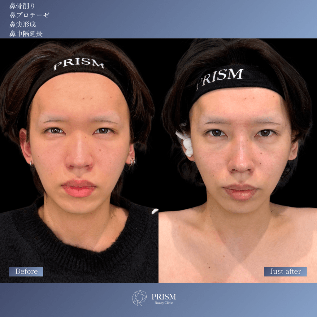 症例のビフォー画像