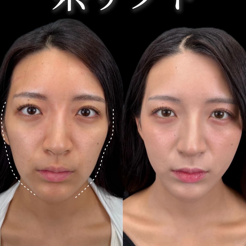 症例のビフォー画像