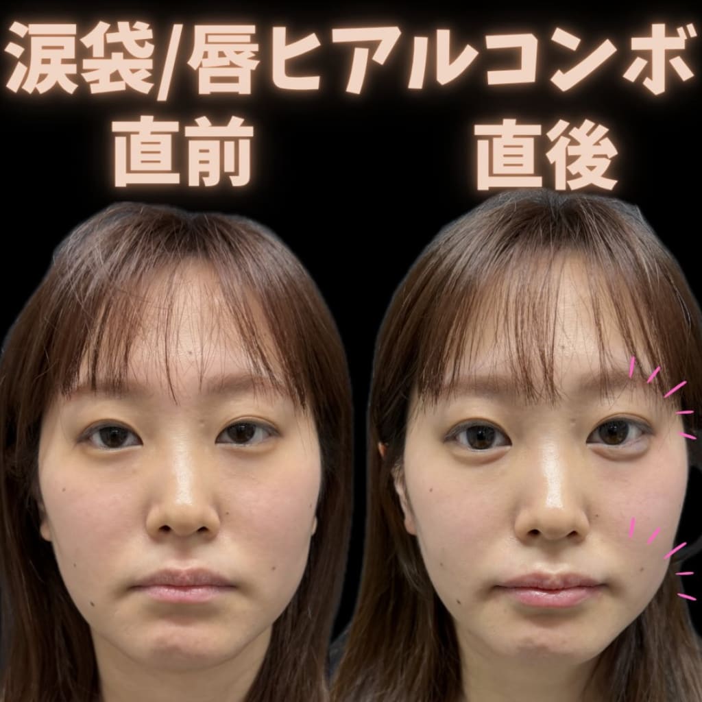 症例のビフォー画像