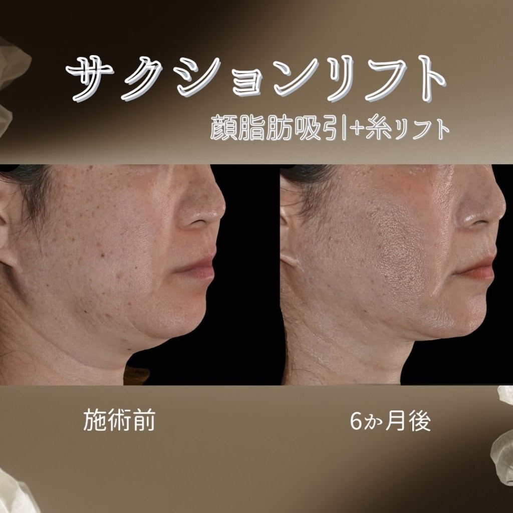 症例のビフォー画像
