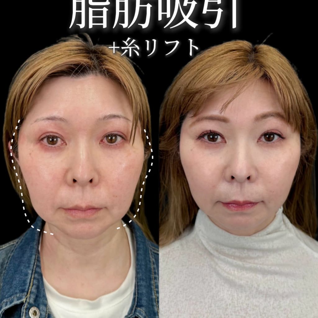 症例のビフォー画像