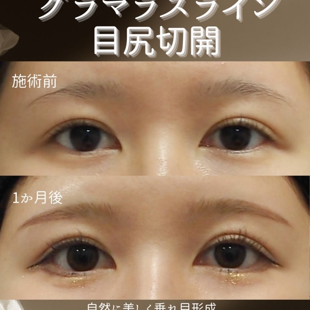 症例のビフォー画像