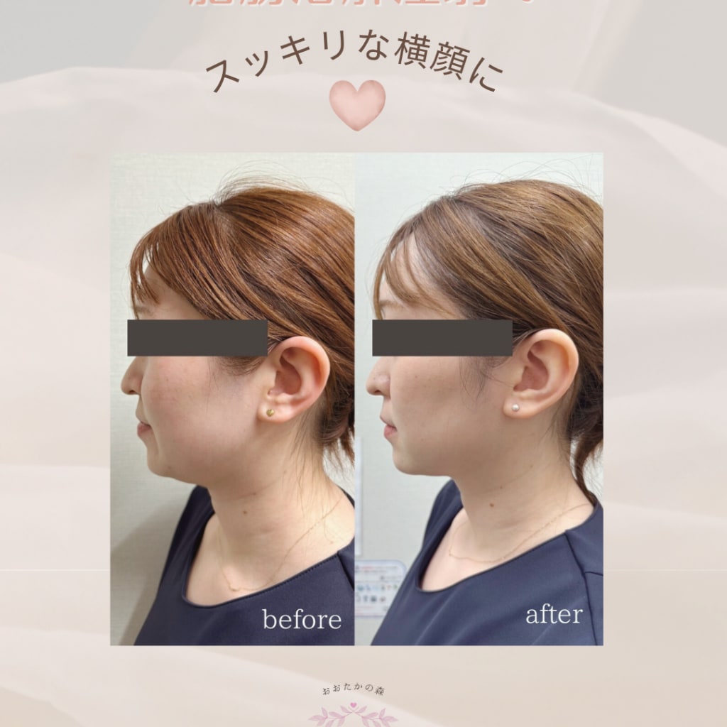 症例のビフォー画像