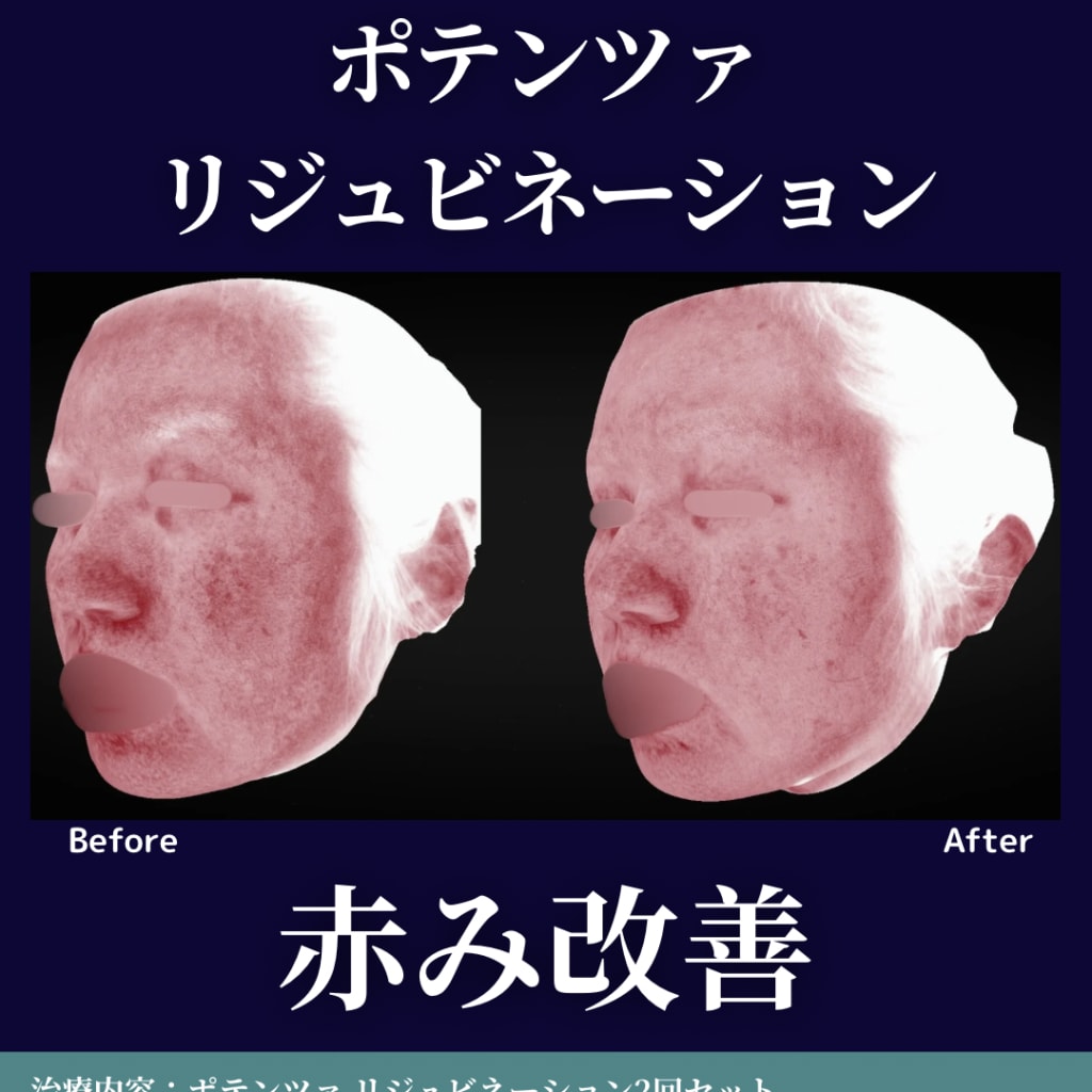 症例のビフォー画像
