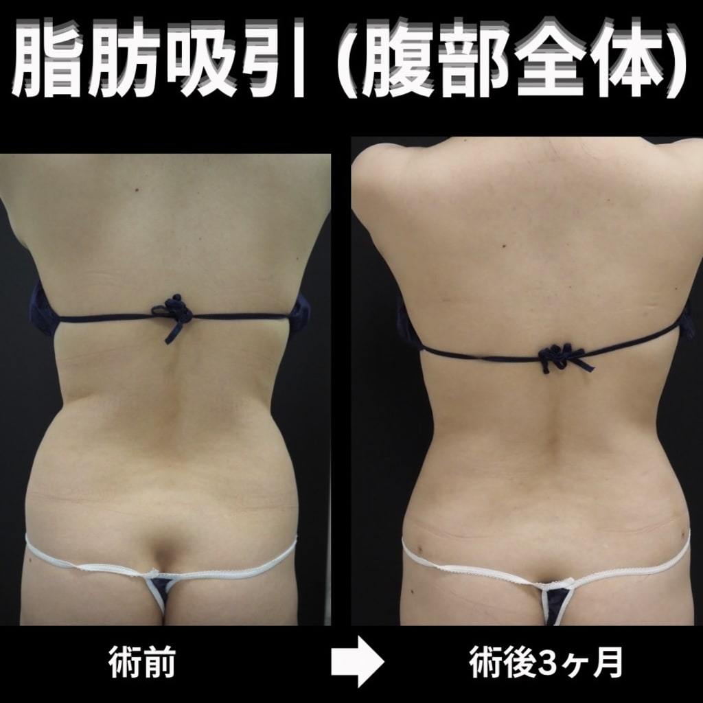 症例のビフォー画像