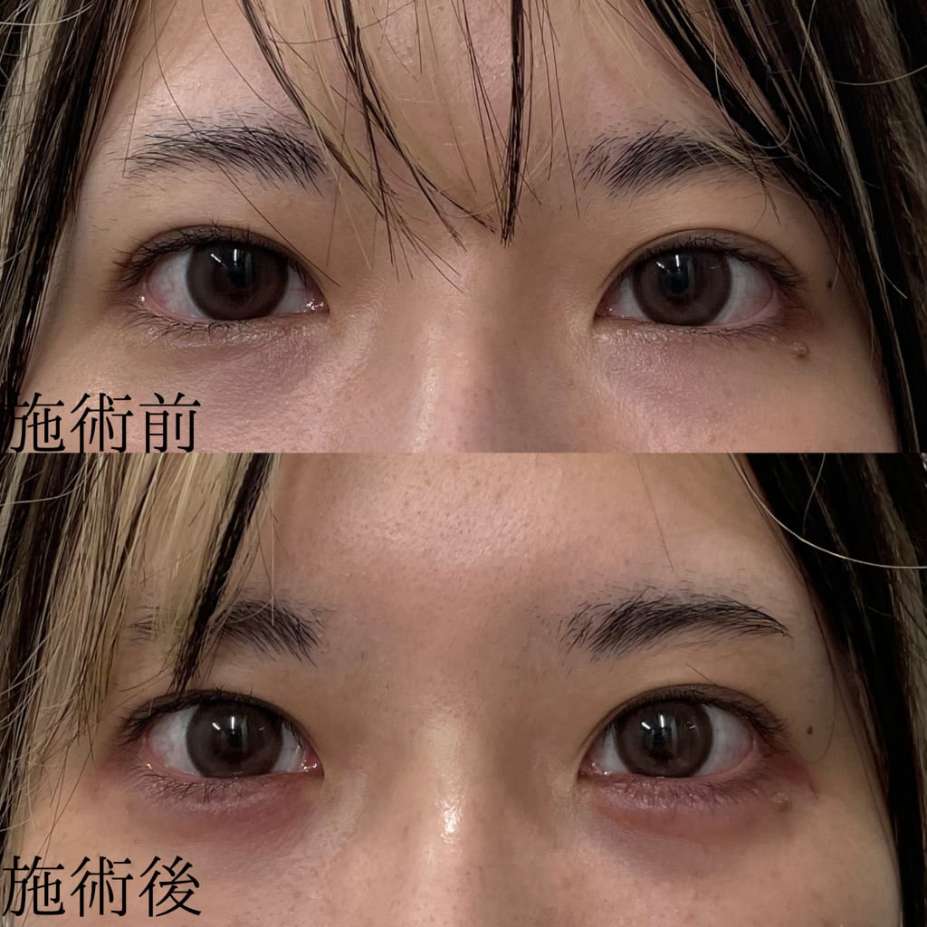 症例のビフォー画像
