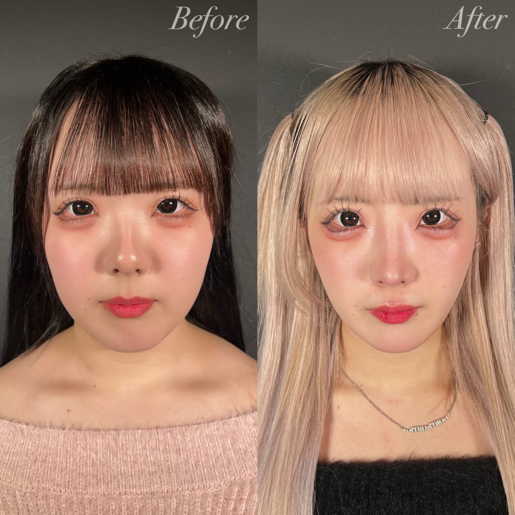 症例のビフォー画像