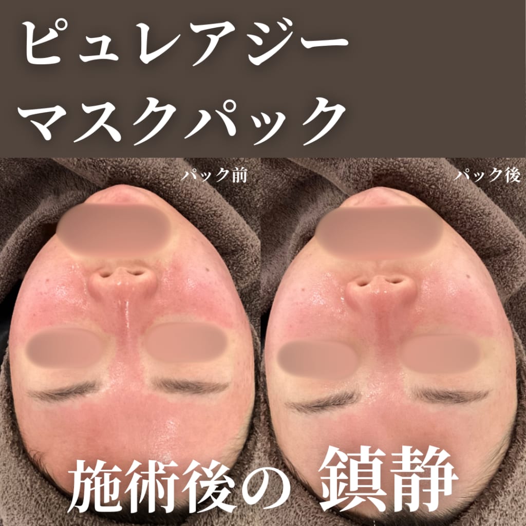 症例のビフォー画像