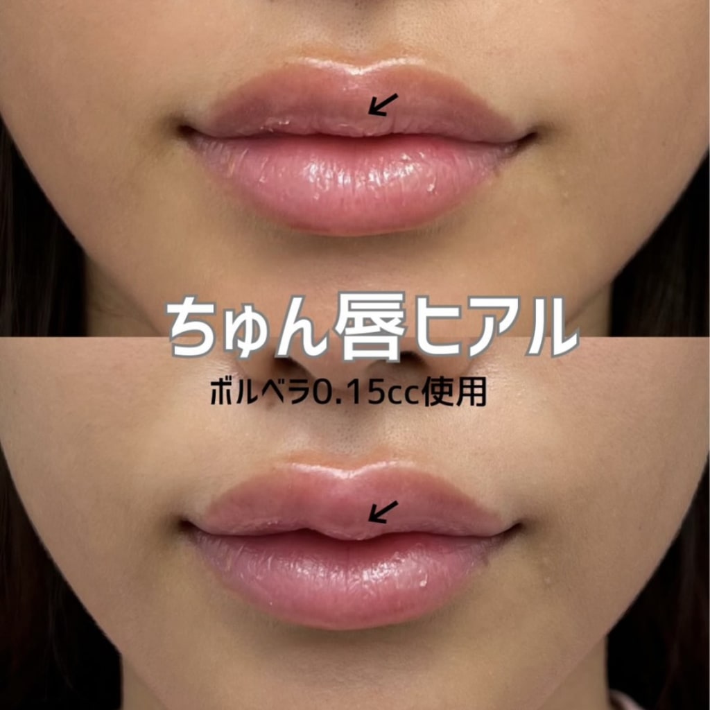 症例のビフォー画像