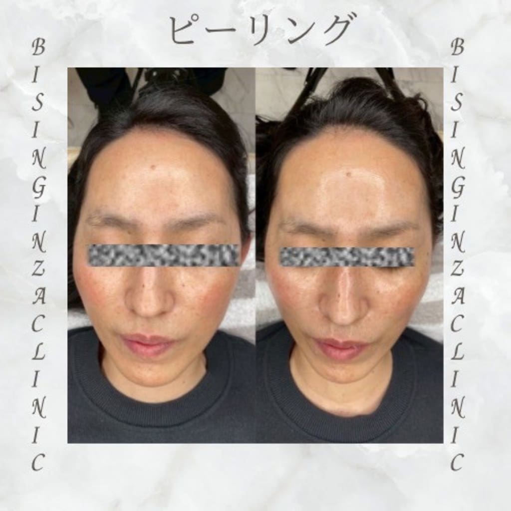 症例のビフォー画像