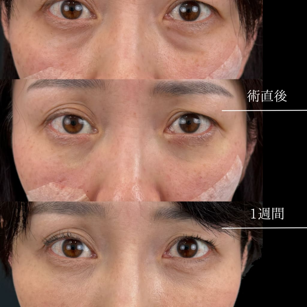 症例のビフォー画像