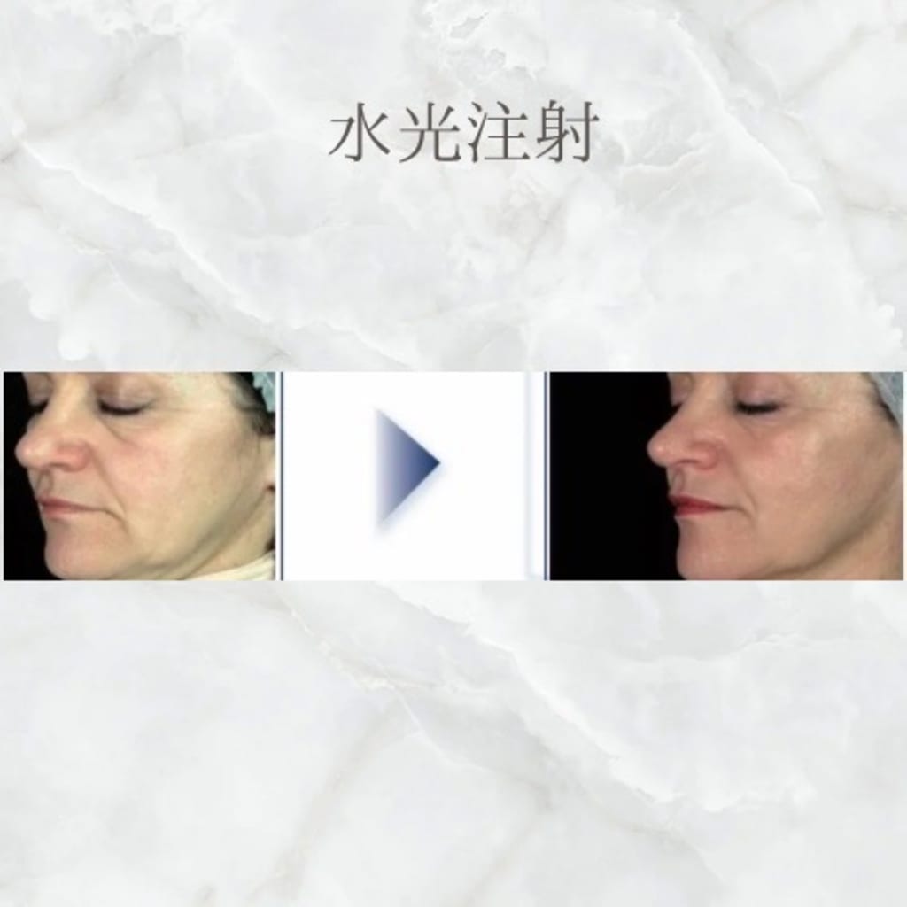 症例のビフォー画像