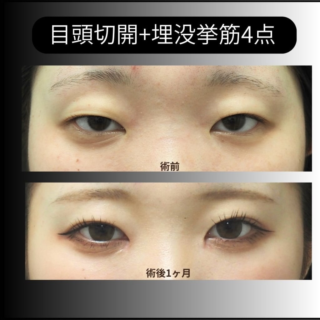 症例のビフォー画像