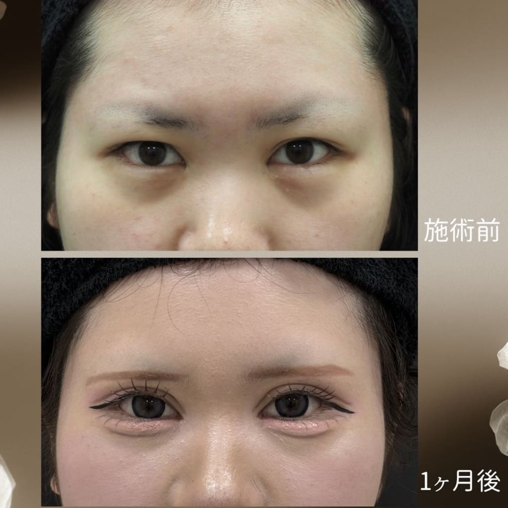 症例のビフォー画像