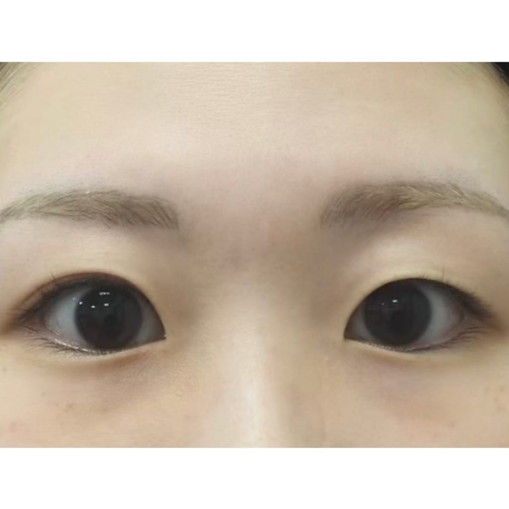 症例のビフォー画像