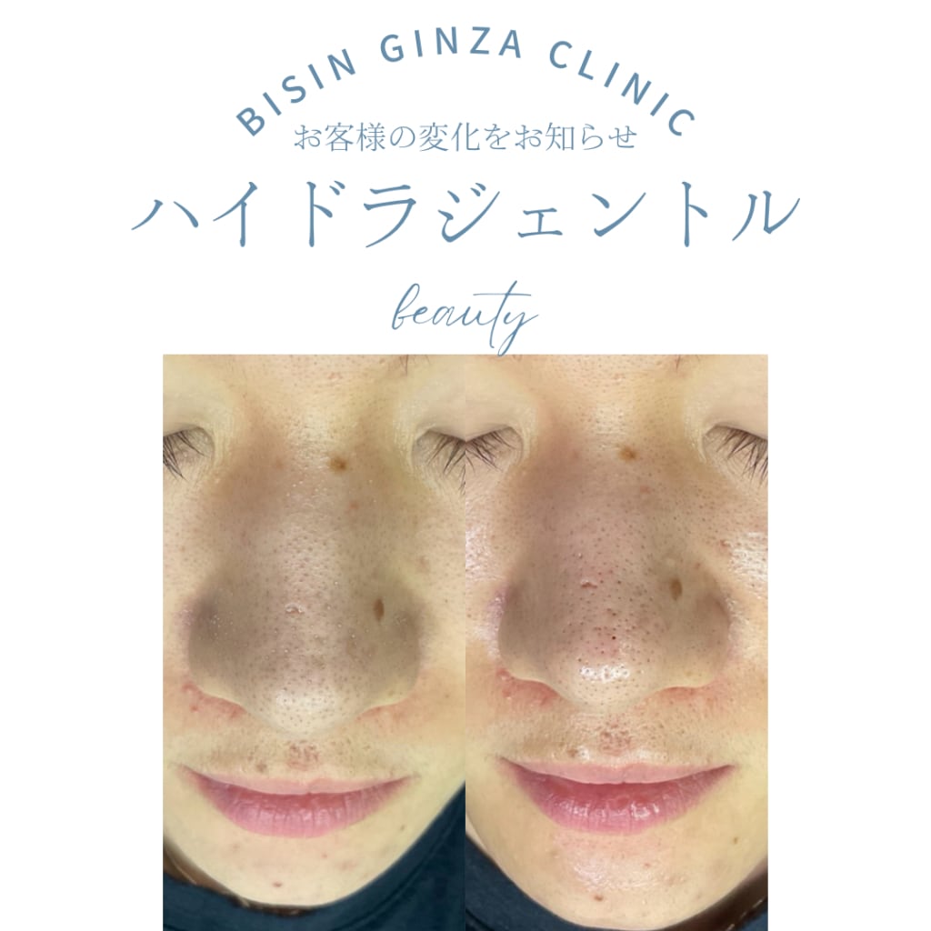 症例のビフォー画像