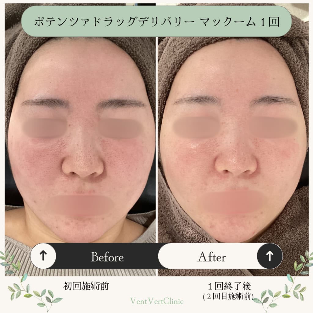症例のビフォー画像