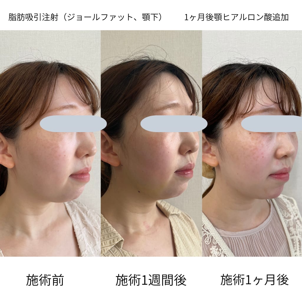 症例のビフォー画像