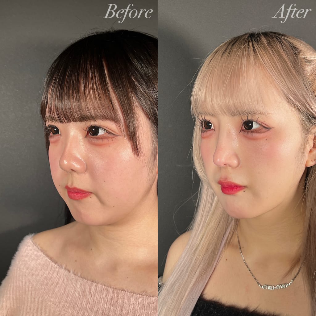 症例のビフォー画像