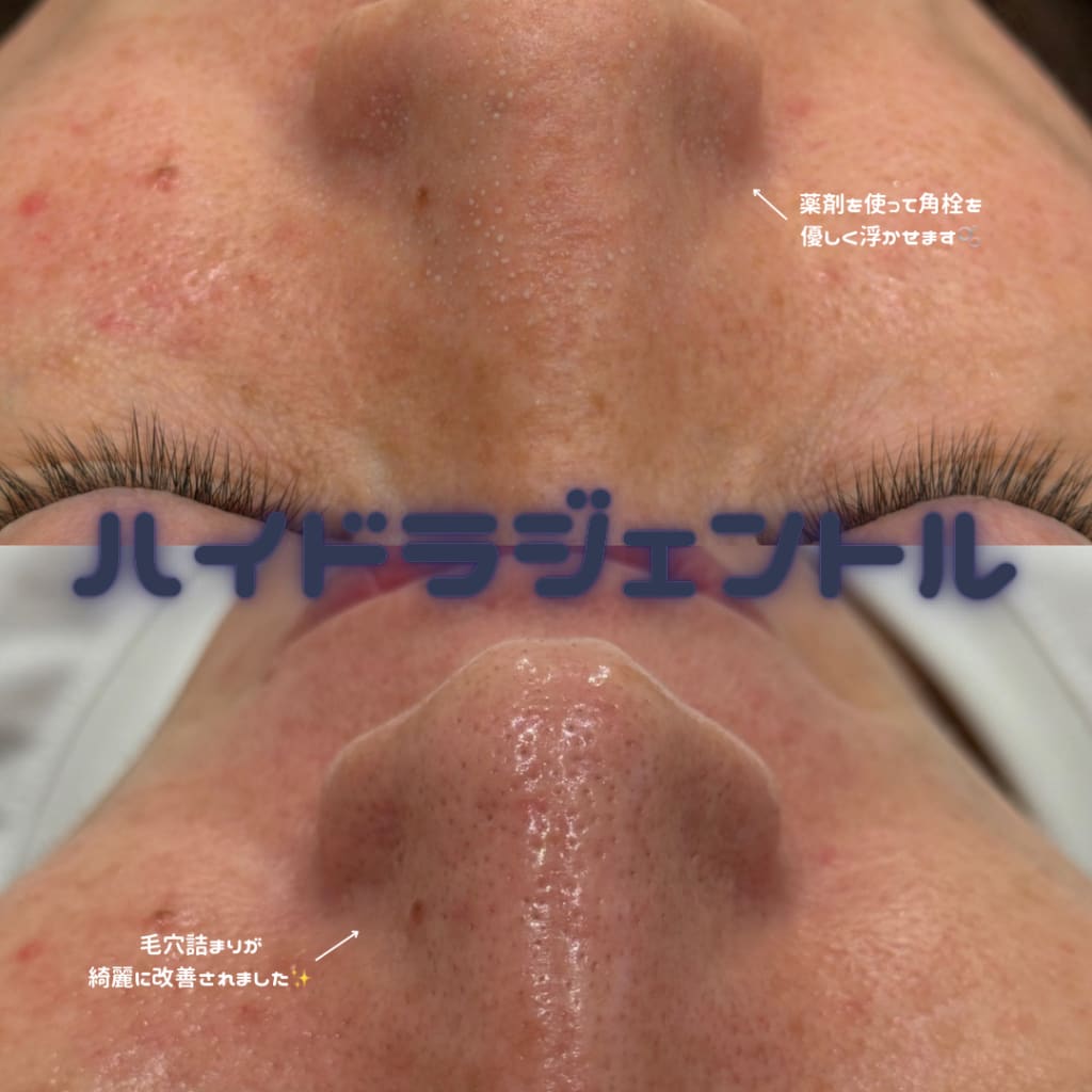 症例のビフォー画像