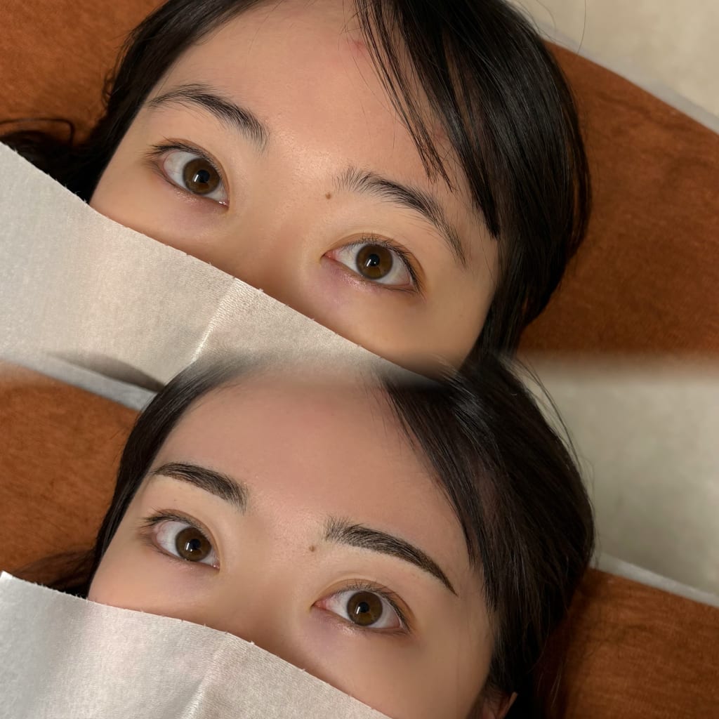 症例のビフォー画像