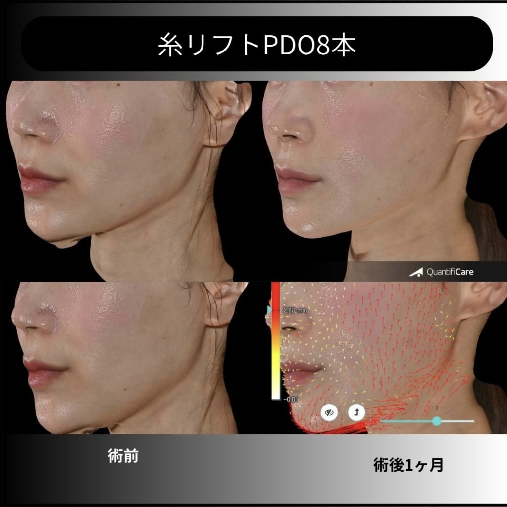 症例のビフォー画像