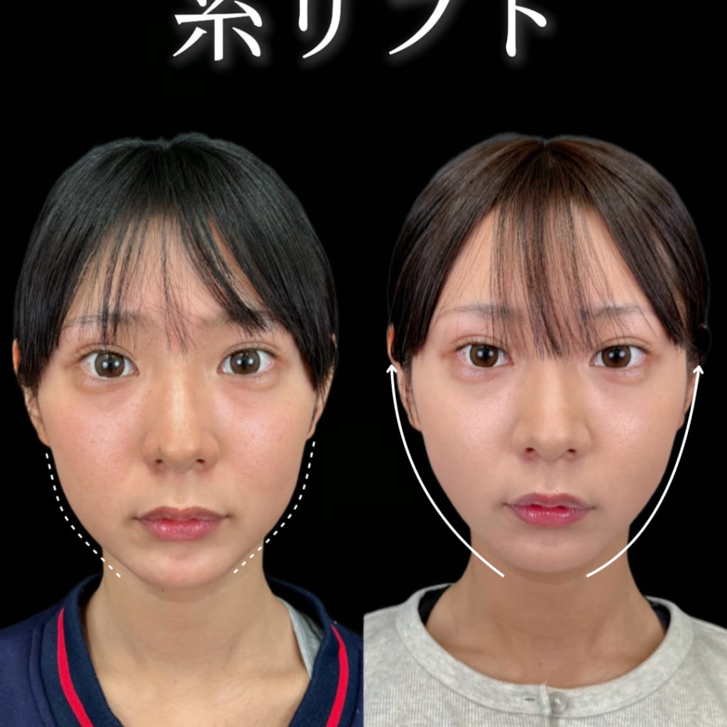 症例のビフォー画像