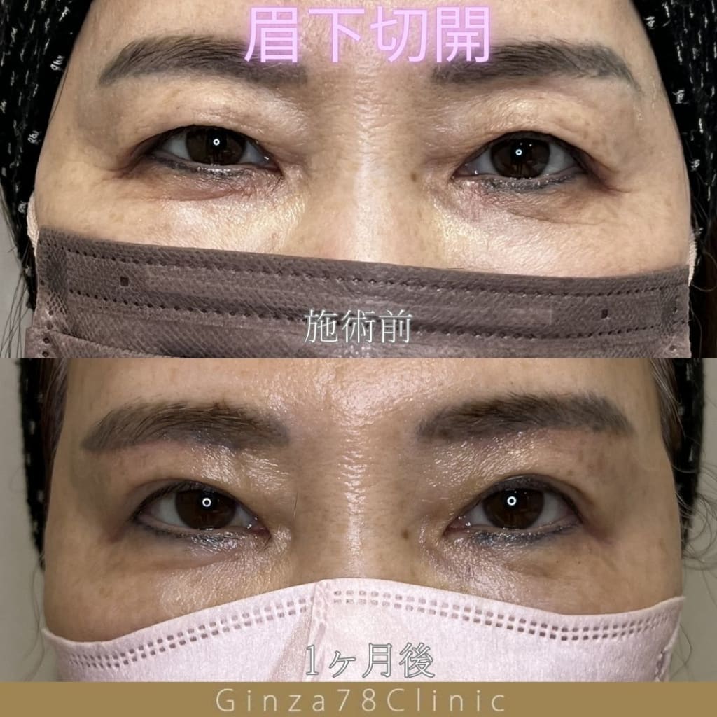 症例のビフォー画像